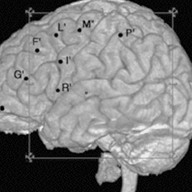 L’unité d’épileptologie de Rennes