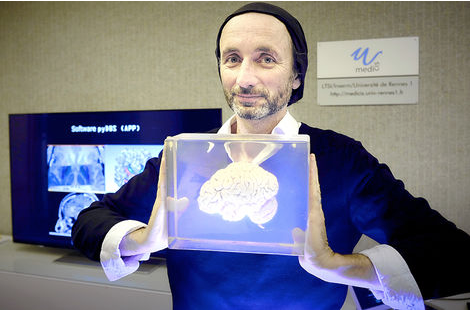 Neurochirurgie 3D Pierre Jannin